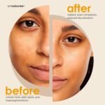 Kojic Acid Soap + African Net Sponge (2 pack X 142g Turmeric bars) Dark spot remover & Scars - Original Japanese Complex Vitamin C, Hyaluronic Acid, retinol, shea butter (Citrus) - Image 5